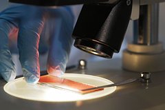 Найден ключ к предотвращению развития рака из воспаления