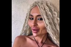 Украинка с самыми большими щеками в мире снялась топлес