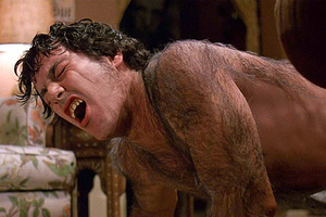 Укус паука-отшельника вызвал у женщины редкую болезнь